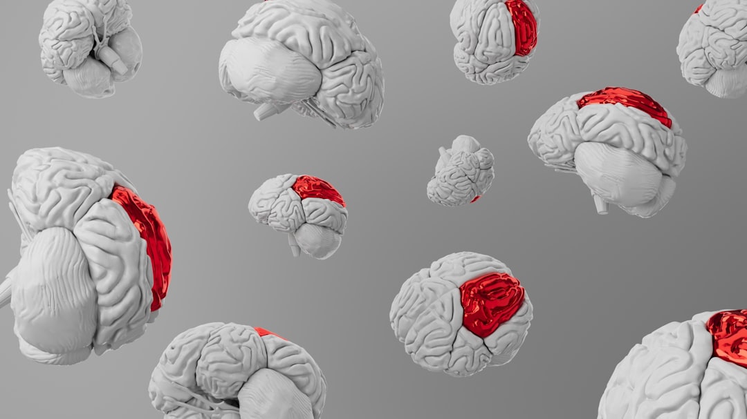 Photo "Second Brain"