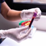 Oboseala care nu trece poate ține de ficat: ce verifici și ce poți schimba în stilul de viață