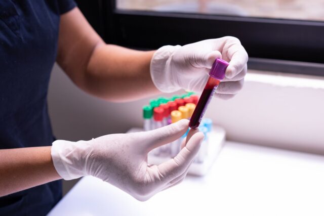 Oboseala care nu trece poate ține de ficat: ce verifici și ce poți schimba în stilul de viață